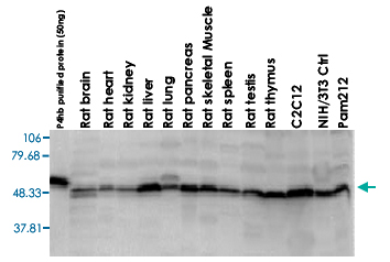 Western Blot (Tissue lysate)