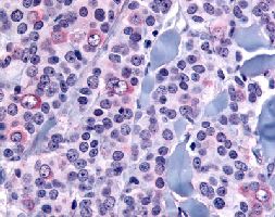 Immunohistochemistry (Formalin/PFA-fixed paraffin-embedded sections)