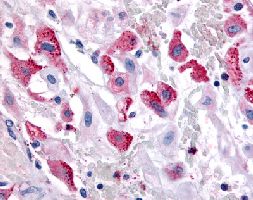 Immunohistochemistry (Formalin/PFA-fixed paraffin-embedded sections)