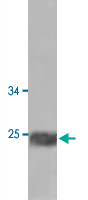 Western Blot (Cell lysate)