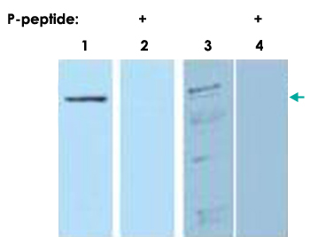 Western Blot