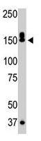 Western Blot (Tissue lysate)