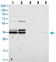 Western Blot