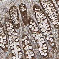 Immunohistochemistry (Formalin/PFA-fixed paraffin-embedded sections)