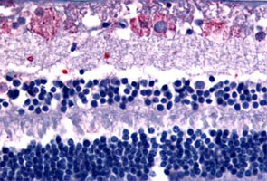 Immunohistochemistry (Formalin/PFA-fixed paraffin-embedded sections)