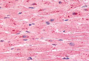 Immunohistochemistry (Formalin/PFA-fixed paraffin-embedded sections)