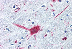 Immunohistochemistry (Formalin/PFA-fixed paraffin-embedded sections)