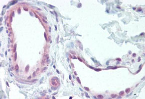 Immunohistochemistry (Formalin/PFA-fixed paraffin-embedded sections)