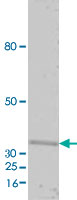 Western Blot (Recombinant protein)