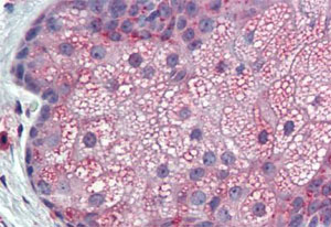 Immunohistochemistry (Formalin/PFA-fixed paraffin-embedded sections)