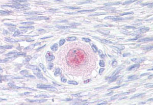 Immunohistochemistry (Formalin/PFA-fixed paraffin-embedded sections)