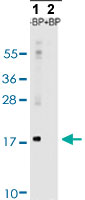 Western Blot (Tissue lysate)