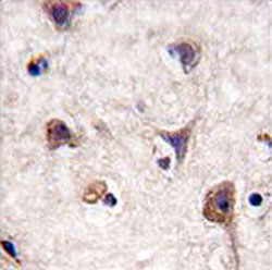 Immunohistochemistry (Formalin/PFA-fixed paraffin-embedded sections)