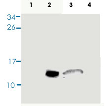 Western Blot