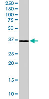 Western Blot (Tissue lysate)