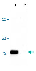 Western Blot (Tissue lysate)