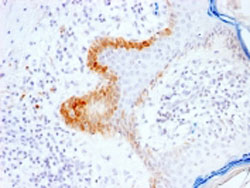 Immunohistochemistry (Formalin/PFA-fixed paraffin-embedded sections)