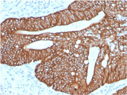 Immunohistochemistry (Formalin/PFA-fixed paraffin-embedded sections)