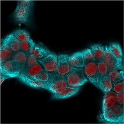 Immunofluorescence