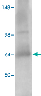 Western Blot (Tissue lysate)