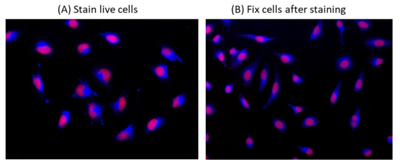 Fluorescence images of endoplasmic reticulum (ER) staining in HeLa cells cultured in a 96-well black-wall clear-bottom plate using fluorescence microscope with a DAPI filter set.