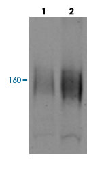 Western Blot (Tissue lysate)