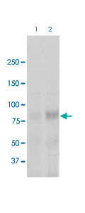 Western Blot (Tissue lysate)