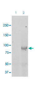 Western Blot (Tissue lysate)