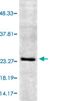 Western Blot (Cell lysate)