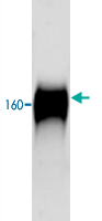 Western Blot (Tissue lysate)