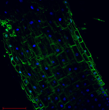 immunolocalization using anti-H+ATPase polyclonal antibodies