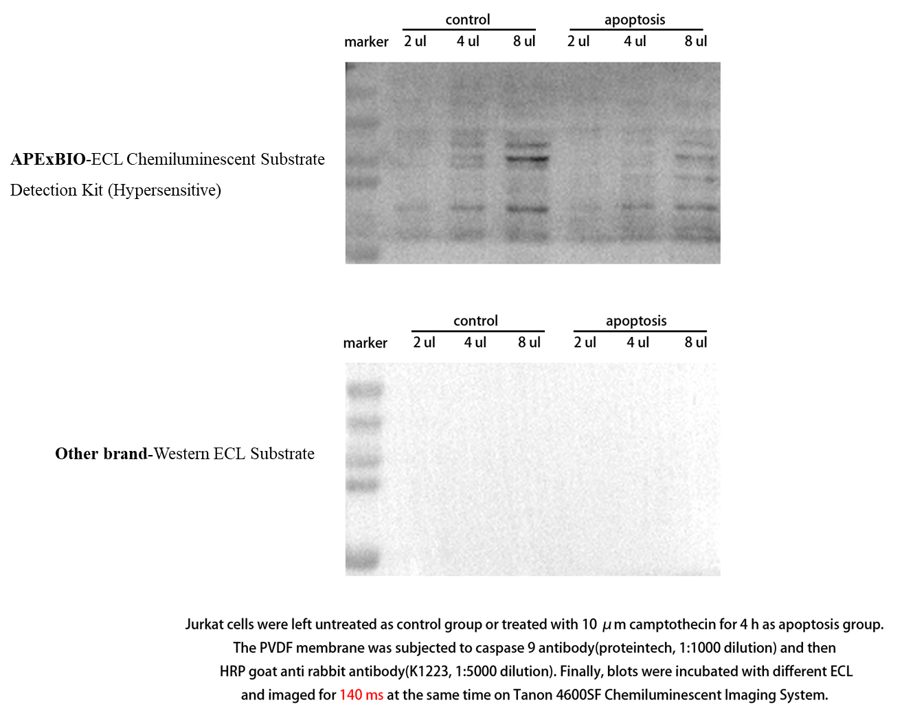 ECL Chemiluminescent Substrate Detection Kit (Hypersensitive)