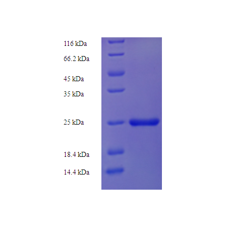 Protein SDS-PAGE