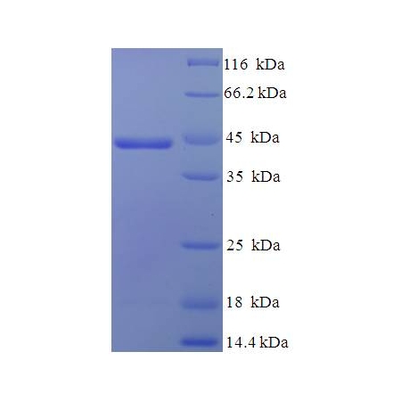 Protein SDS-PAGE