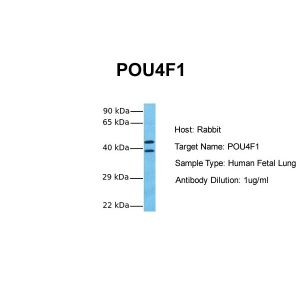 Human Fetal Lung