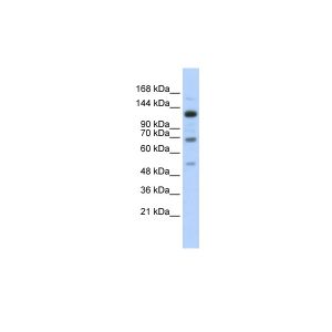 Transfected 293T 