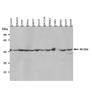 Western Blot