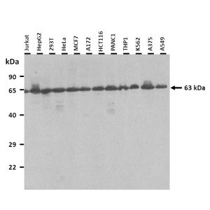 Western Blot