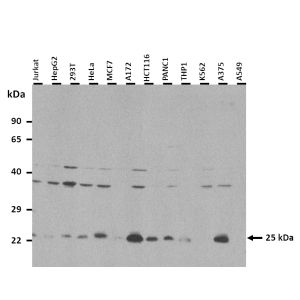 Western Blot