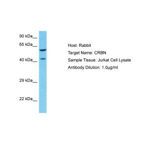 Human Jurkat Whole Cell