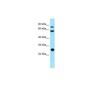 Mouse Thymus