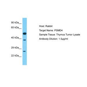 Human Thymus Tumor