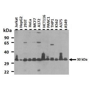 Western Blot