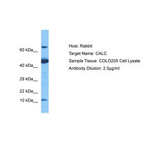 Human COLO205 Whole Cell