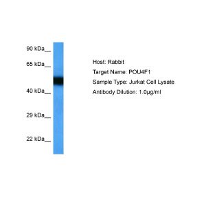 Human Jurkat Whole Cell