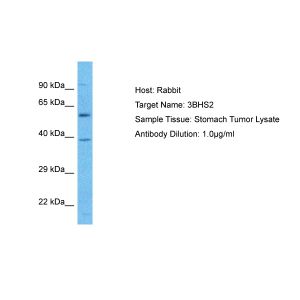 Human Stomach Tumor