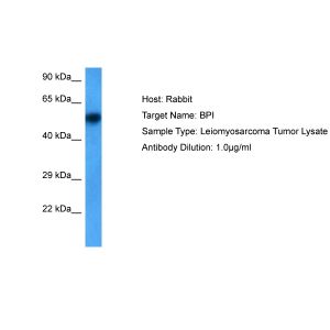 Human Leiomyosarcoma Tumor