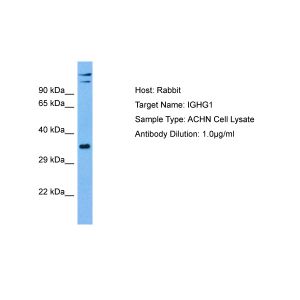 Human ACHN Whole Cell