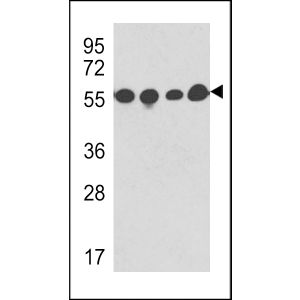 Y79, CEM, 293 cell, mouse brain tissue