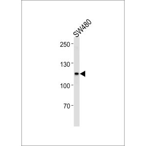 SW480, U251 cell